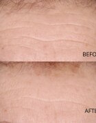 Perricone MD Hypoallergenic Clean Correction Smoothing Restorative Serum изглаждащ серум за хидратация и озаряване на кожата 59 мл.