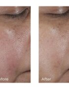 Perricone MD No:Rinse Pore Minimizing Toner интензивен тоник за изглаждане на кожата и минимизиране на порите 118 мл.