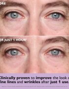 Peter Thomas Roth Instant FIRMx Collagen Infusion Tighteneing Eye Patches стягащи възглавнички с гел за подочната зона 1 бр.