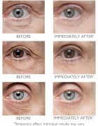 Peter Thomas Roth Instant FIRMx Eye околоочен крем за подмладяване на кожата на лицето 15 мл.
