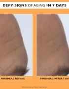 Peter Thomas Roth Potent-C Power Serum озаряващ серум против бръчки 30 мл.