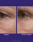Peter Thomas Roth Ultimate Solution 5 Multitasking Eye Cream богат хидратиращ крем за очи 15 мл.