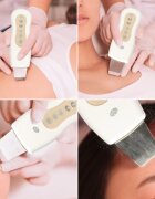 RIO Ultrasonic Facial уред за почистване на лице 1 бр.