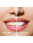 RIO USB teeth whitening комплект за избелване на зъби