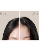 RYO Root:Gen Hair Loss Care Treatment укрепваща грижа против косопад за жени 353 мл.