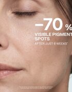 Saffee LiftUp Vitamin C + B3 Serum озаряващ серум Против тъмни петна с витамин С + B3 30 мл.