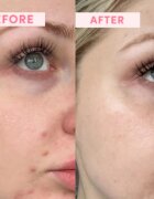 Sand & Sky Australian Emu Apple Resurfacing Mask изглаждаща маска за възобновяване на повърхността на кожата 60 гр.