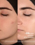 SKINSOO PurifyCell Exosome Cleanser ексфолиращ почистващ гел 250 мл.