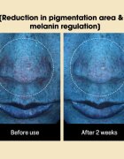Some By Mi Yuja Niacin Anti Blemish Daily Mask озаряваща платнена маска да уеднакви цвета на кожата голяма опаковка 30 бр.
