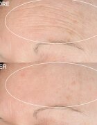 StriVectin Anti-Wrinkle SD Advanced Plus концентриран крем за намаляване на бръчките 118 мл.
