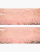 The Ordinary Hyaluronic Acid 2% + B5 хидратиращ серум с церамиди 60 мл.