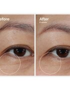 The Ordinary Lacto-PDRN* 4% + B9 Eye Cream изглаждащ околоочен крем против бръчки за околоочния контур 15 мл.
