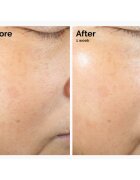 The Ordinary Rice Lipids + Ectoin Microemulsion лека хидратираща емулсия за успокояване на кожата 120 мл.