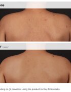 The Ordinary Salicylic Acid 0.5% Body Serum усъвършенстващ серум за тяло със салицилова киселина 240 мл.