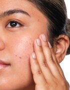 The Ordinary Salicylic Acid 2% Solution серум със салицилова киселина 30 мл.