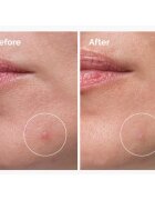 The Ordinary Sulfur 10% Powder-to-Cream Concentrate локална грижа против акне 5 гр.