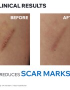 Uriage Bariederm Cica+ Repairing Cream репариращ крем съдържащ мед и цинк 100 мл.
