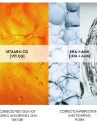 Vichy Normaderm Anti-Age дневен крем против първи бръчки за мазна и проблемна кожа 50 мл.