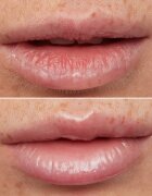 WONDERSKIN Lip Rehab Therapy Oil масло от нар с хидратиращ ефект цвят Clear 357 мл.