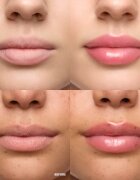WONDERSKIN Lip Relapse Plumping Gloss блясък за устни с увеличаващ ефект цвят Clear 3.57 мл.