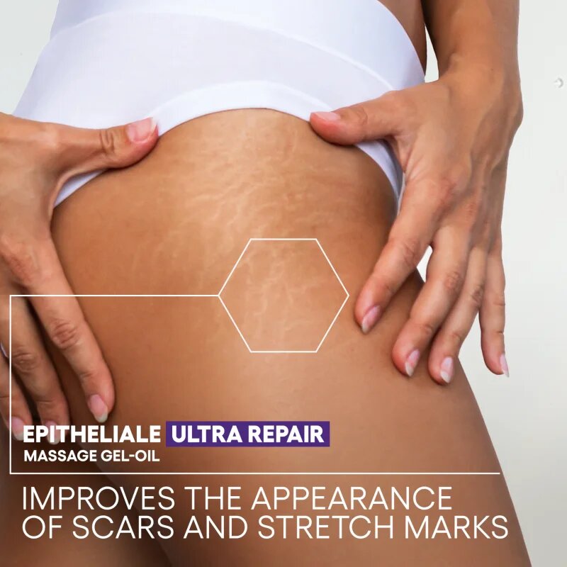 A-Derma Epitheliale A.H. Duo Massage Gel-Oil масажно гел-масло за белези и стрии 40 мл.