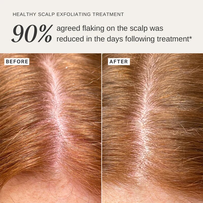 Alpha-H Healthy Scalp ексфолиращ разтвор за глава 100 мл.