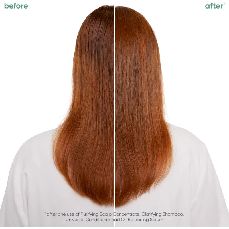 Biolage ScalpSync серум за коса за мазна коса 50 мл.