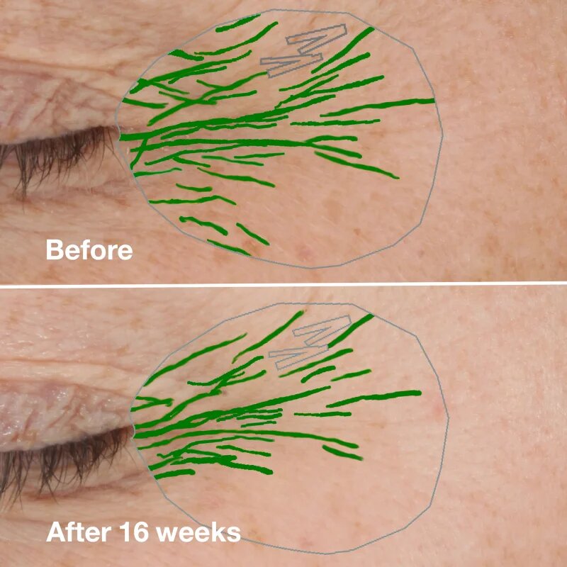 Clinique Smart Clinical™ Repair Wrinke Correcting Serum серум за лице за коригиране на бръчки 50 мл.