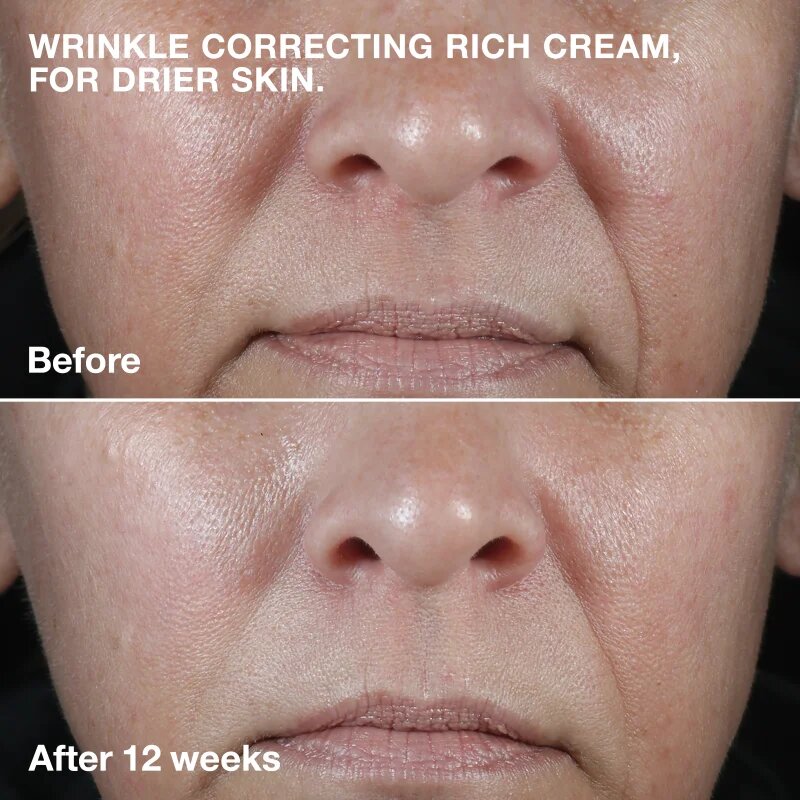 Clinique Smart Clinical™ Repair Wrinkle Correcting Cream подхранващ крем против бръчки 50 мл.