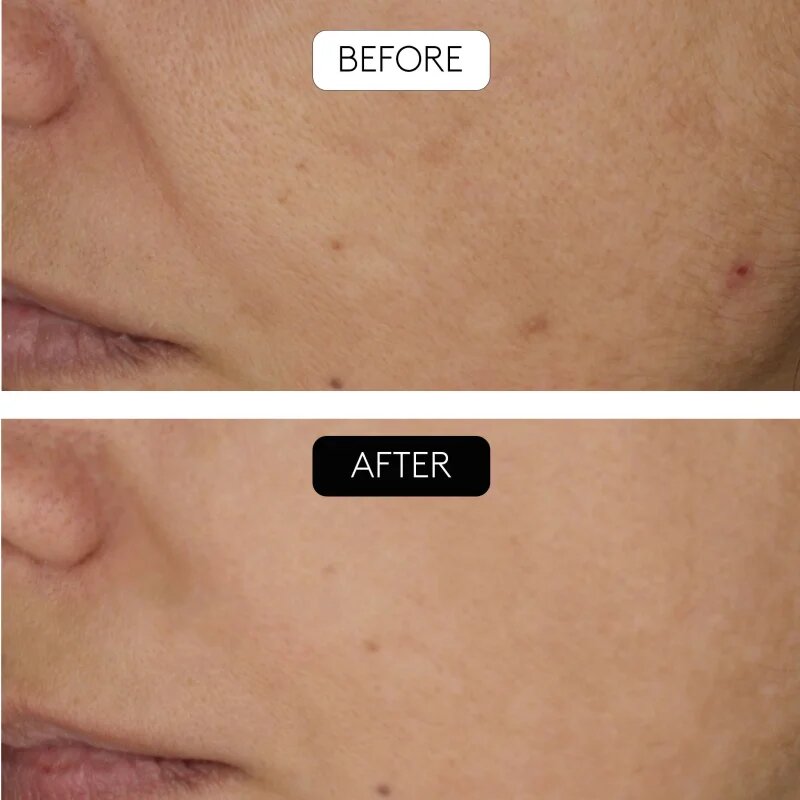 Cocunat Clinical Beauty Filler серум против стареене на кожата с микронидълинг 5 мл.