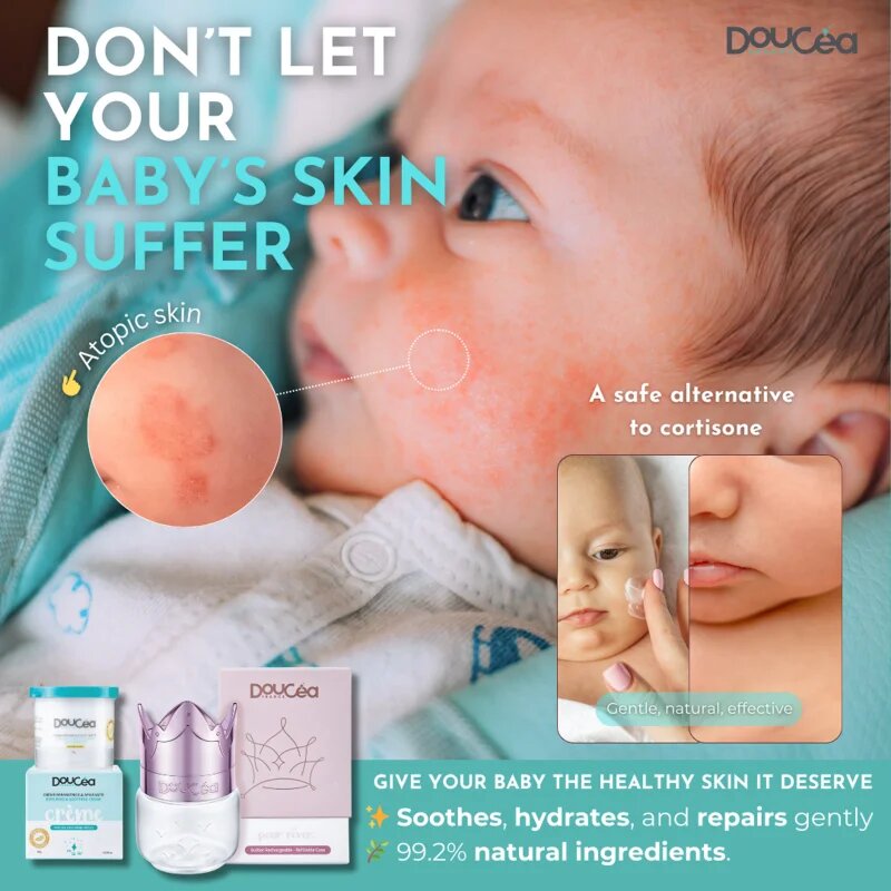 Doucea Doutopia Cream регенериращ крем за атопична кожа при деца и възрастни 50 гр.