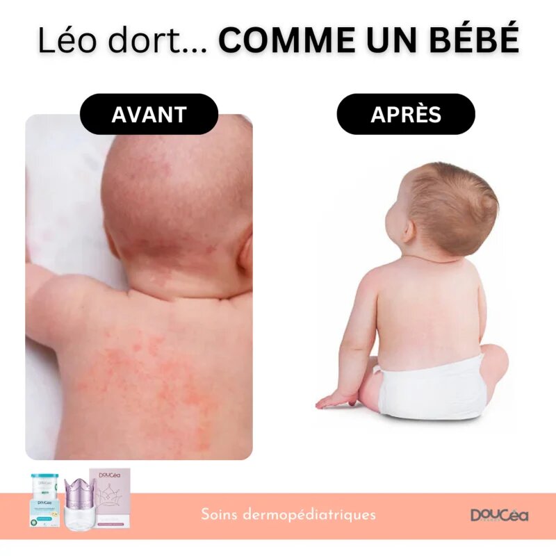 Doucea Doutopia Cream регенериращ крем за атопична кожа при деца и възрастни 50 гр.