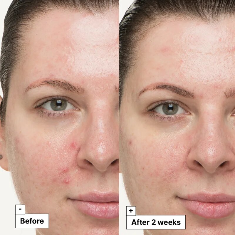 Dr. Jart+ Cicapair™ So Soothing Treatment концентрат за проблемна кожа неутрализиращ зачервяването 30 мл.