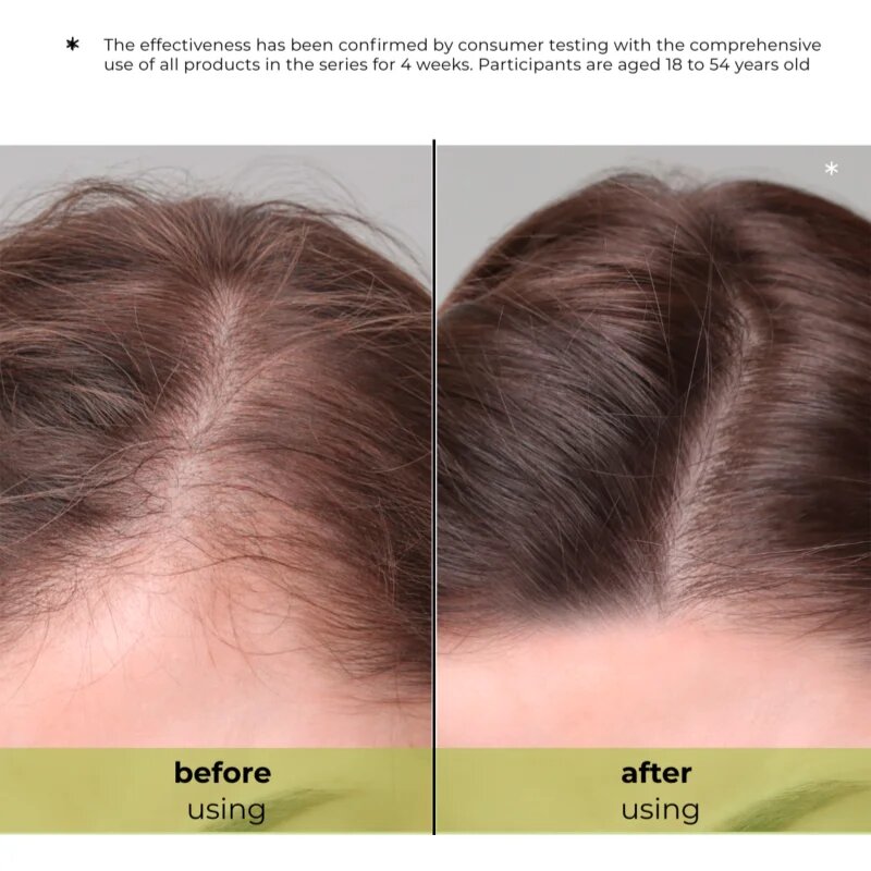 Elfa Pharm Intensive Cosmetic Complex Of 7 Oils 7in1 Stimulating Serum регенериращ серум против косопад 100 мл.