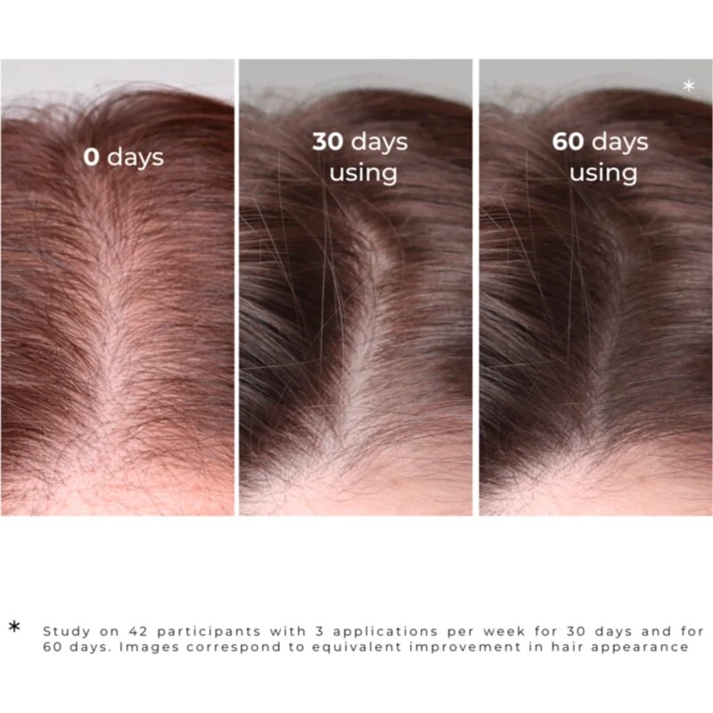 Elfa Pharm Intensive Cosmetic Intensive Hair Therapy Burdock Serum серум против косопад с активатор за растеж 100 мл.