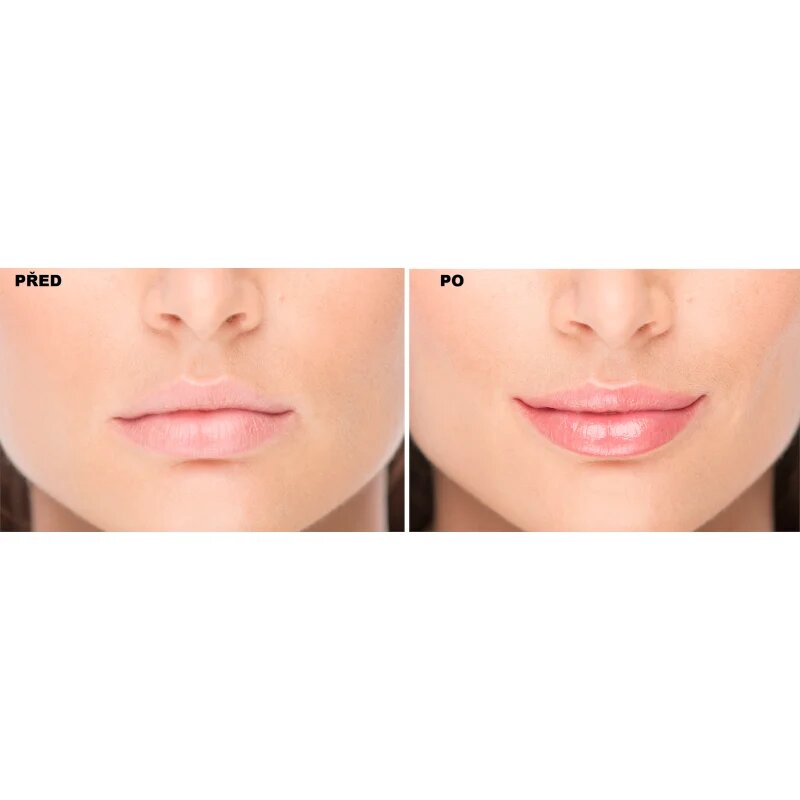 FacEvolution LipPlus Booster грижа за увеличаване обема на устните цвят Transparent 5 мл.