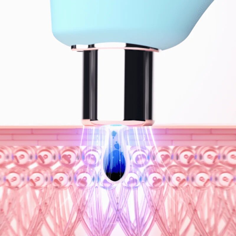 FOREO KIWI™ вакуумен уред за премахване на черни точки със синя LED светлина 1 бр.