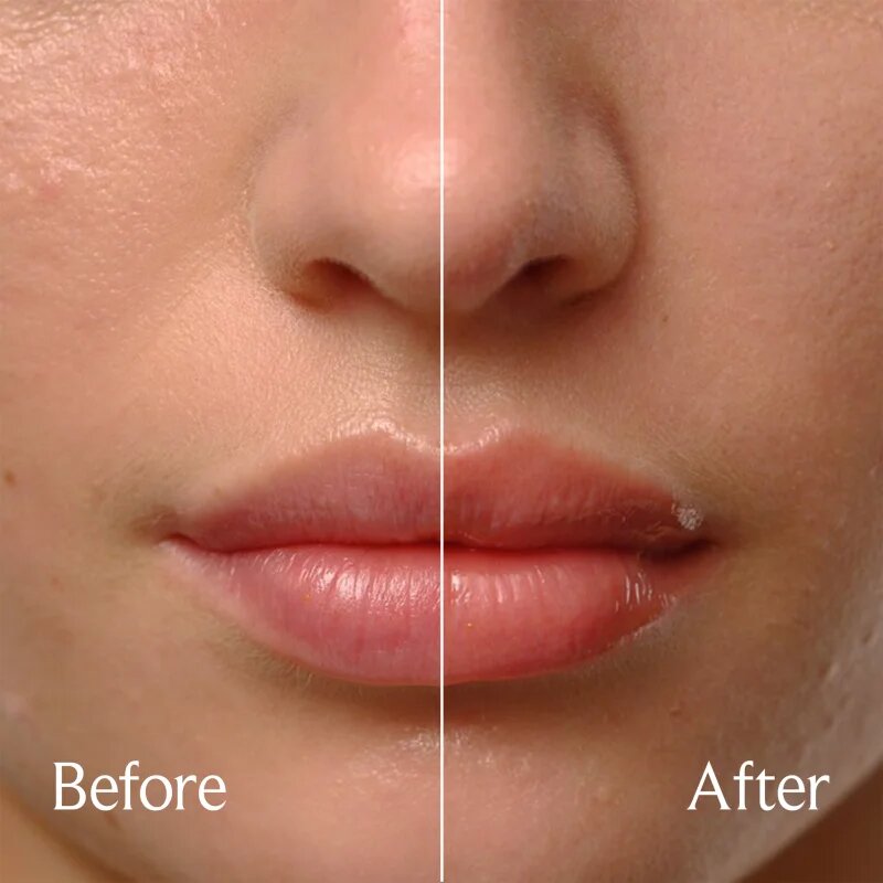 fresh Sugar Treat Lip Oil масло от нар лимитирано издание цвят Honey 4 мл.