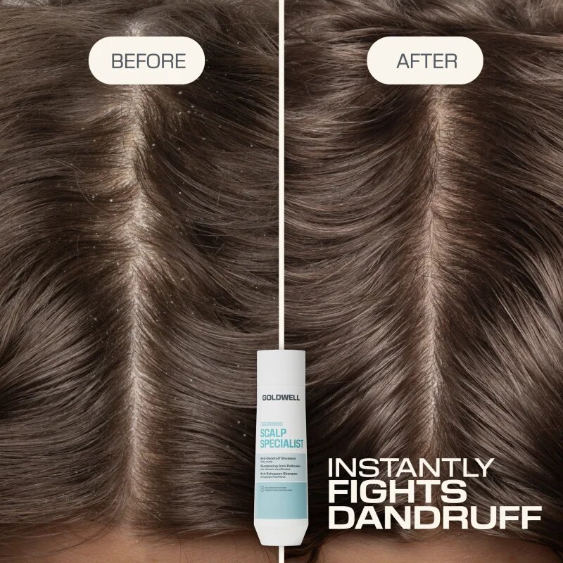 Goldwell Dualsenses Scalp Specialist Anti-Dandruff Shampoo шампоан против пърхот 250 мл.