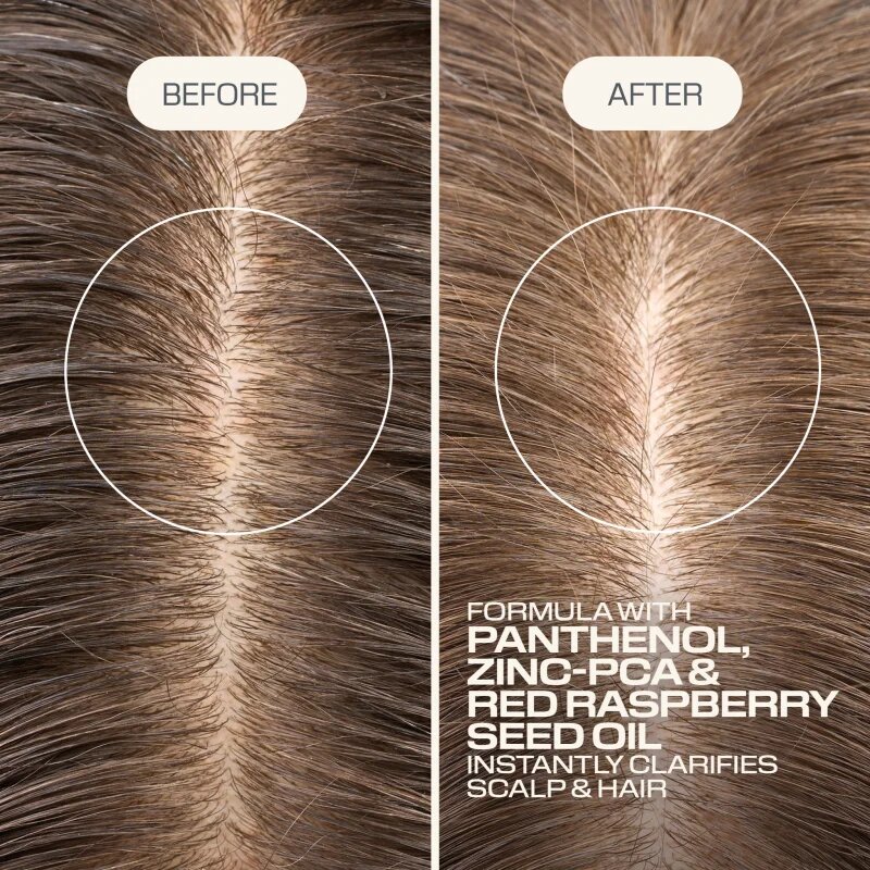 Goldwell Dualsenses Scalp Specialist Clarifying Shampoo дълбоко почистващ шампоан 1000 мл.