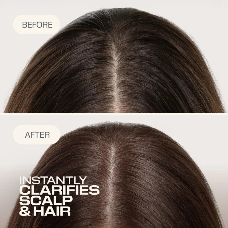 Goldwell Dualsenses Scalp Specialist Clarifying Shampoo дълбоко почистващ шампоан 250 мл.