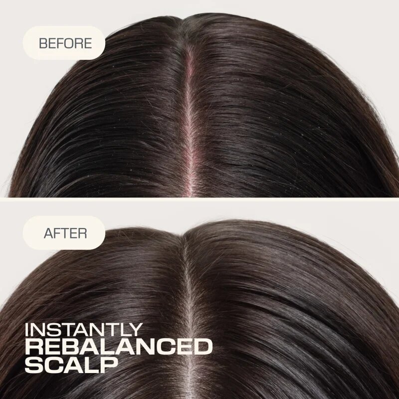 Goldwell Dualsenses Scalp Specialist Rebalance & Hydrate Fluid хидратиращ флуид за възобновяване на скалпа 150 мл.