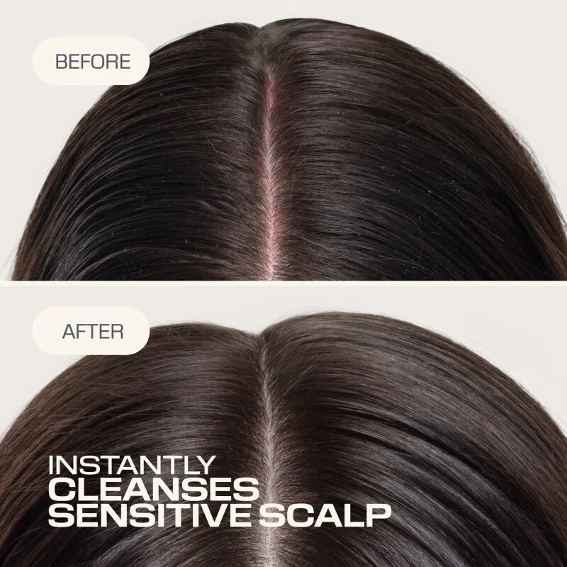 Goldwell Dualsenses Scalp Specialist Sensitive Foam Shampoo шампоан с пяна за чувствителна кожа на скалпа 250 мл.