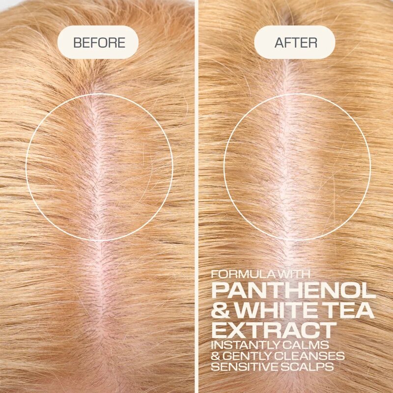 Goldwell Dualsenses Scalp Specialist Sensitive Foam Shampoo шампоан с пяна за чувствителна кожа на скалпа 250 мл.