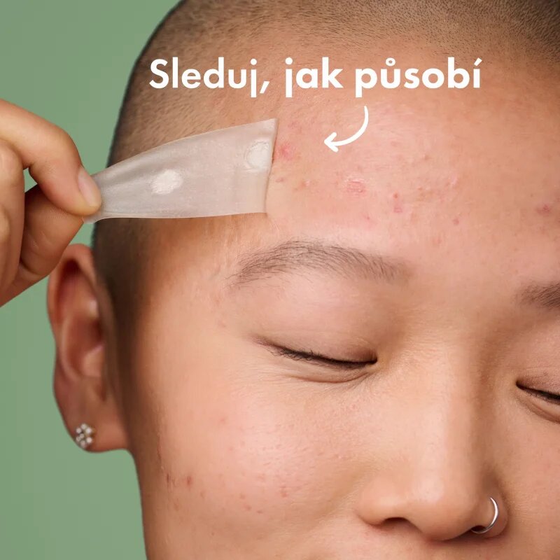 Hero Cosmetics Mighty Patch XL лепенки за проблемна кожа 10 бр.