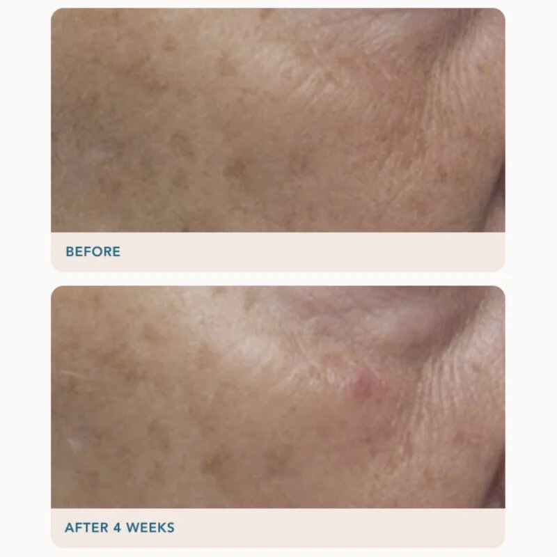 LANCER GRAVITY DARK SPOT CORRECTING SERUM серум Против тъмни петна 30 мл.
