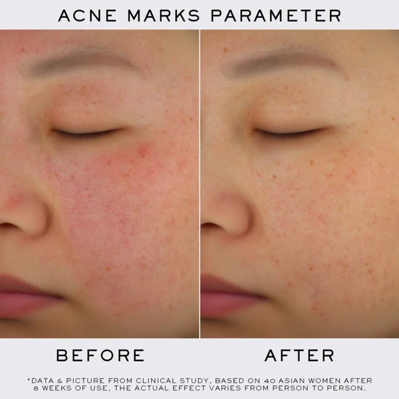 Lancôme Clarifique Refining Brightening Pro-Solution озаряващ серум 50 мл.