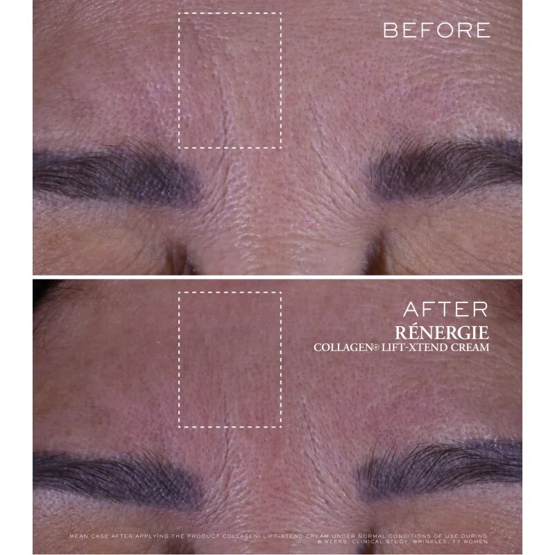 Lancôme Rénergie Collagen+ Lift-Xtend Cream крем за лице с колаген 50 мл.
