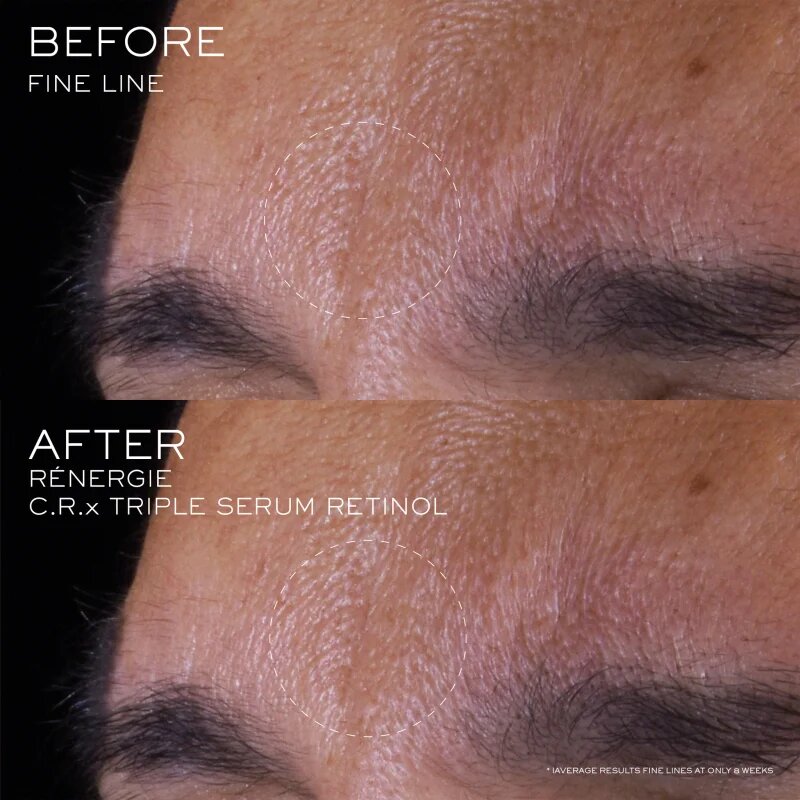 Lancôme Rénergie CRX Triple Serum Retinol серум за лице 20 мл.