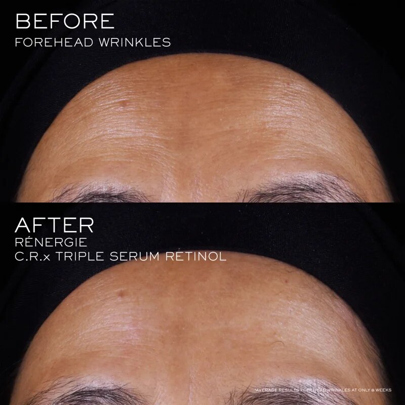 Lancôme Rénergie CRX Triple Serum Retinol серум за лице 20 мл.